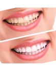 Hot System Dental Wybielanie Zębów 44% Nadtlenku Wybielanie Zestaw Żel Wybielacza Zębów Oral Dental Equipment Drop Shipping
