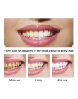 LANBENA Zęby Wybielanie Istotą Proszku Oral Hygiene Czyszczenie Serum Usuwa Tablica Plamy Zębów Wybielanie Stomatologiczne Narzę