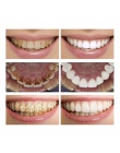 LANBENA Zęby Wybielanie Istotą Proszku Oral Hygiene Czyszczenie Serum Usuwa Tablica Plamy Zębów Wybielanie Stomatologiczne Narzę