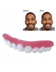 Profesjonalne Idealny Uśmiech Licówki Dub W Magazynie Dla Korekty Zęby Zęby Na Złe Idealne Uśmiech Licówki