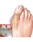 Żel silikonowy Stóp Toe Separator Prostownica Kciuk Palucha Koślawego Korektor Ortopedyczne Stóp Protector Zespół Cieśni Kanału 