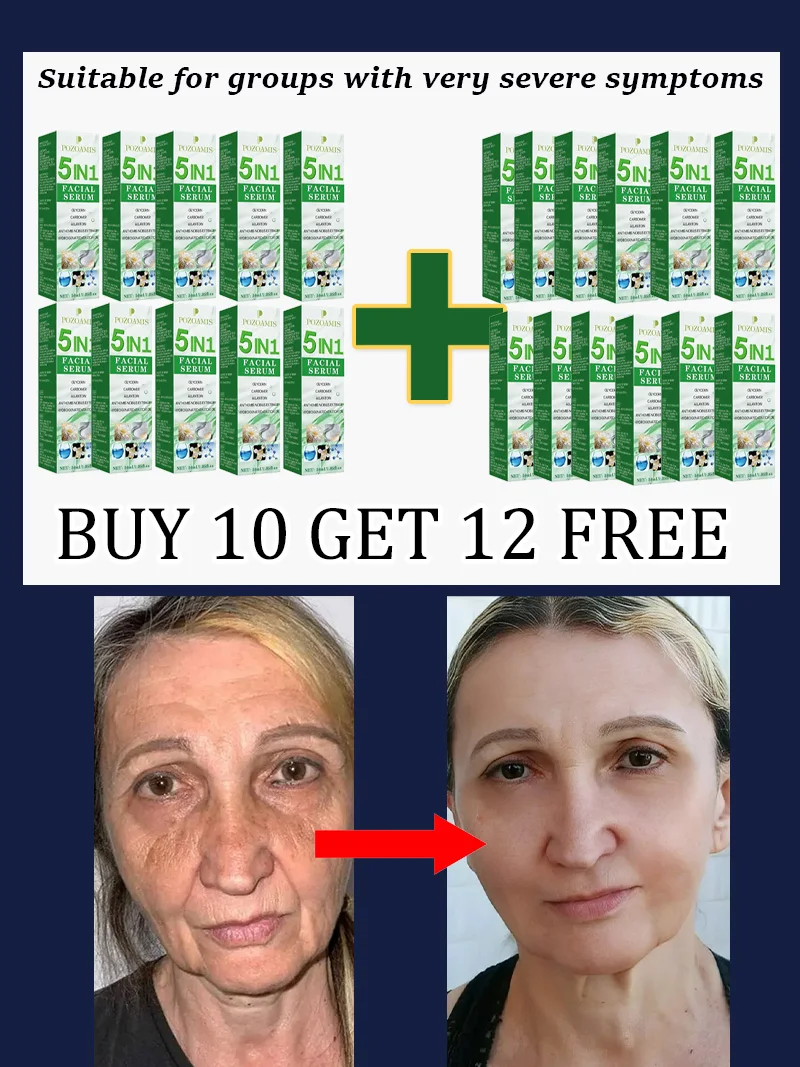 Serum do twarzy 5 w 1 przeciwzmarszczkowe, nawilżające i ujędrniające Buy 10 get 12 free
