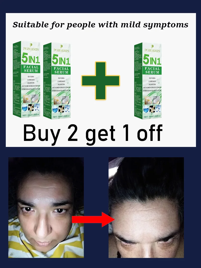 Serum do twarzy 5 w 1 przeciwzmarszczkowe, nawilżające i ujędrniające Buy 2 get 1 free