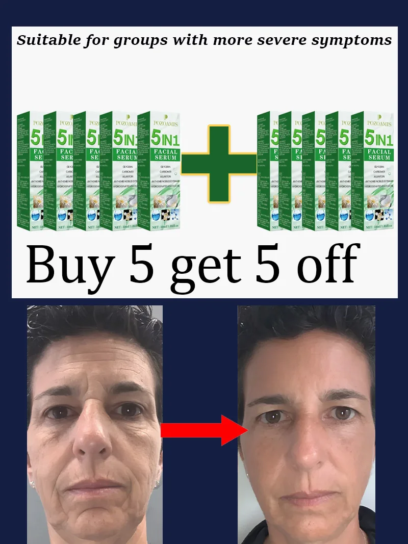 Serum do twarzy 5 w 1 przeciwzmarszczkowe, nawilżające i ujędrniające Buy 5 get 5 free